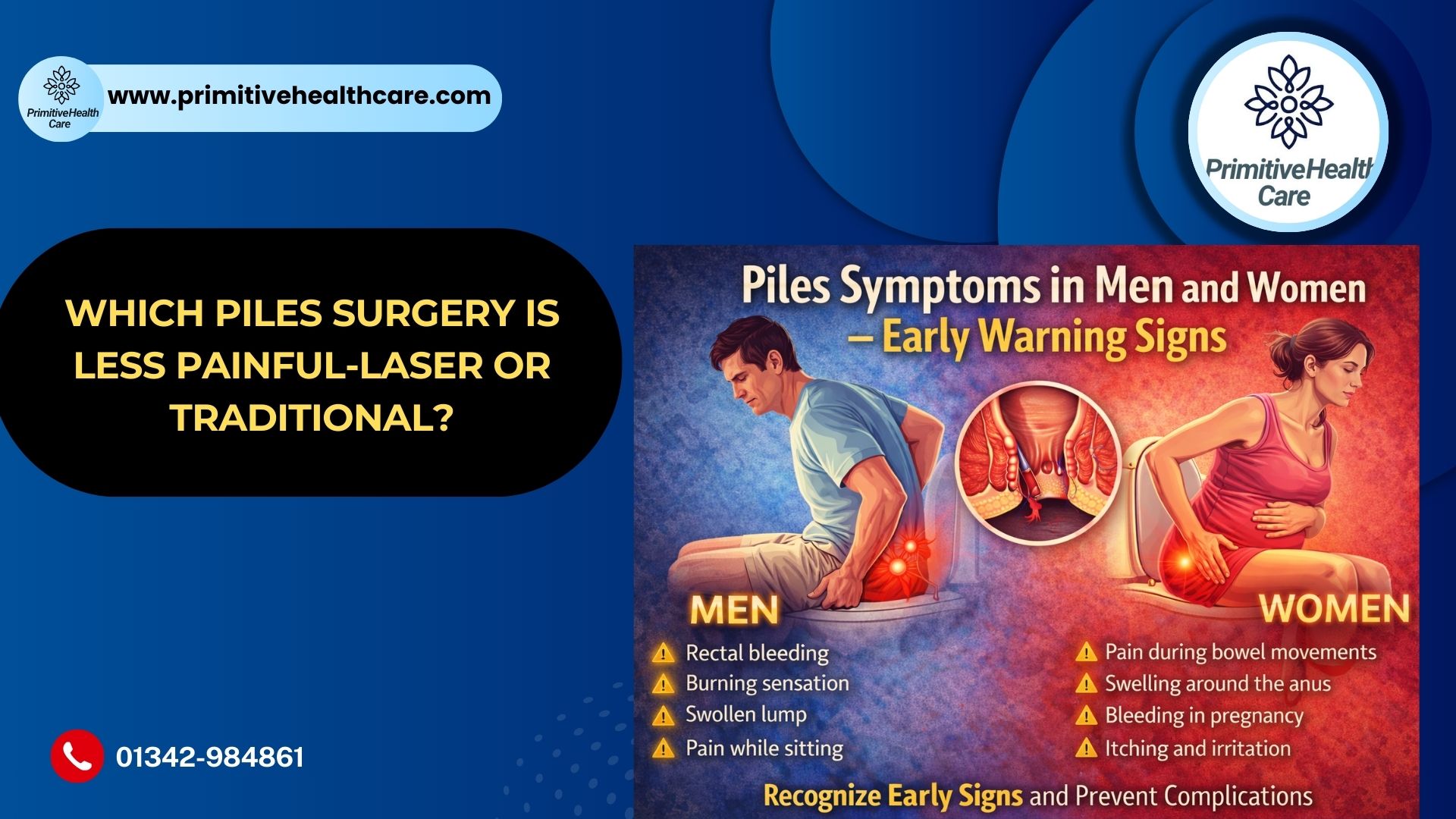 Piles Symptoms in Men and Women – Early Warning Signs